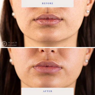 BioRepublic SkinCare Lip Masks 6pk - New - Image 4