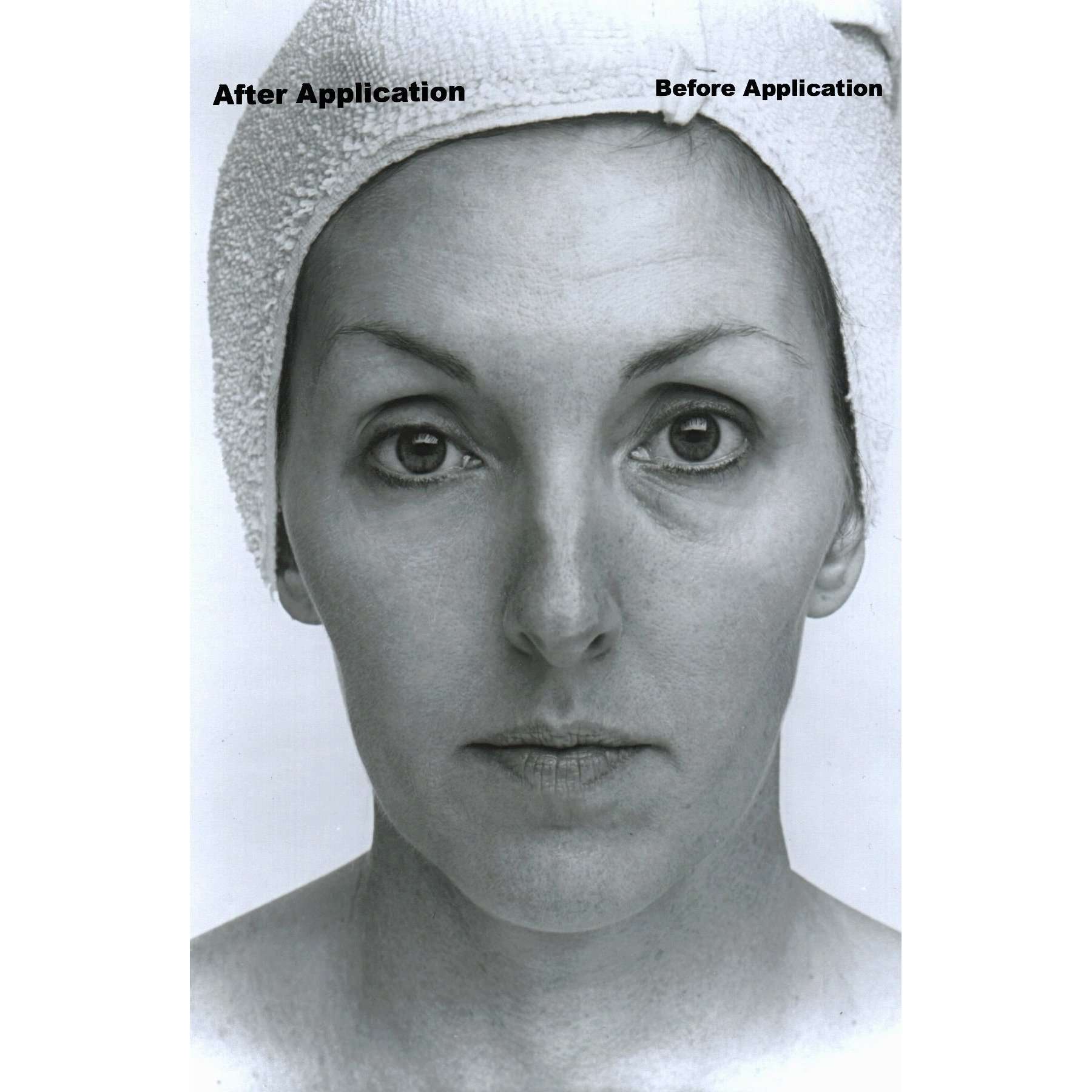 Collagen Lifting Facial with Rapid Wrinkle Erase Cream - Image 2