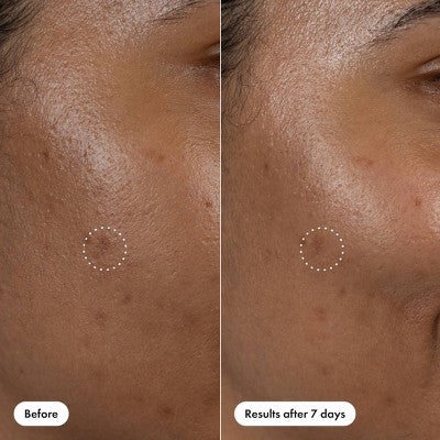 Hero Cosmetics Dark Spot Correct Serum Pen 10ml - Image 8
