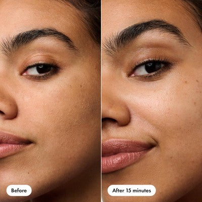 Hero Cosmetics Rescue Patch 6ct - Image 5