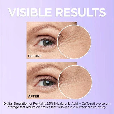 L'Oreal Paris Revitalift Derm Intensives Hyaluronic Acid+Caffeine 0.67 fl oz - Imperfect Box - Image 7