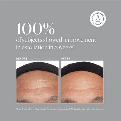 Naturium Azelaic Topical Acid 10% 1 fl oz - Imperfect Box - Image 8