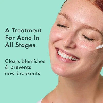 Rael Miracle Clear Complete Acne Treatment Face Serum 1oz - Image 3