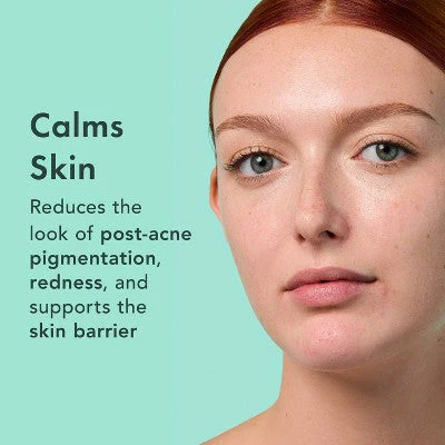 Rael Miracle Clear Complete Acne Treatment Face Serum 1oz - Image 5