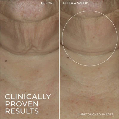 RoC Derm Correxion Retinol Face Stick - Imperfect Box - Image 5