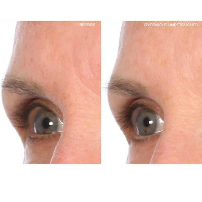 SiO Beauty Brow Lift Face Mask 1ct - Image 3