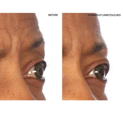 SiO Beauty Super-Lift Pack Brow Eye Smile Patches - Image 3