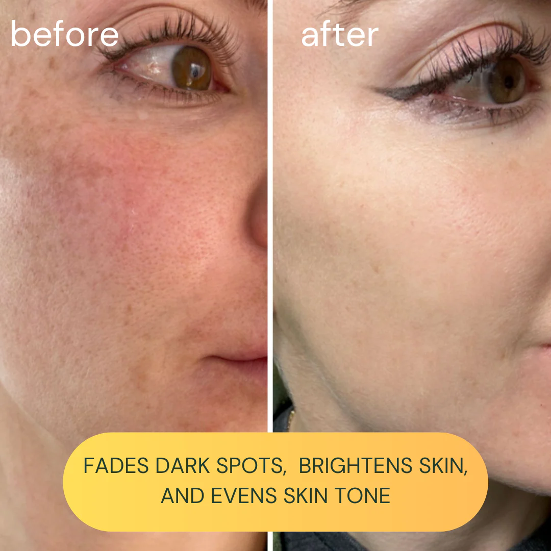 Vit-C Brightening Oil - Image 3